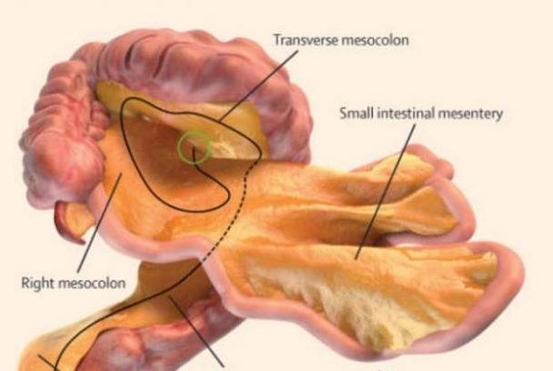 سیر و پیاز، رفلاکس و IBS را تشدید می‌کنند