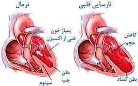 از درد پا تا سکته مغزی؛ نشانههای پنهان بیماریهای عروقی/کنترل قند و چربی خون ،خط مقدم مقابله با بیماریهای عروقی