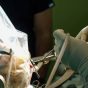 جراحی کاشت الکترود در مغز برای درمان صرع مقاوم به دارو