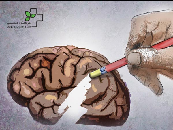 سن ابتلا به آلزایمر به ۴۹‌سالگی رسید